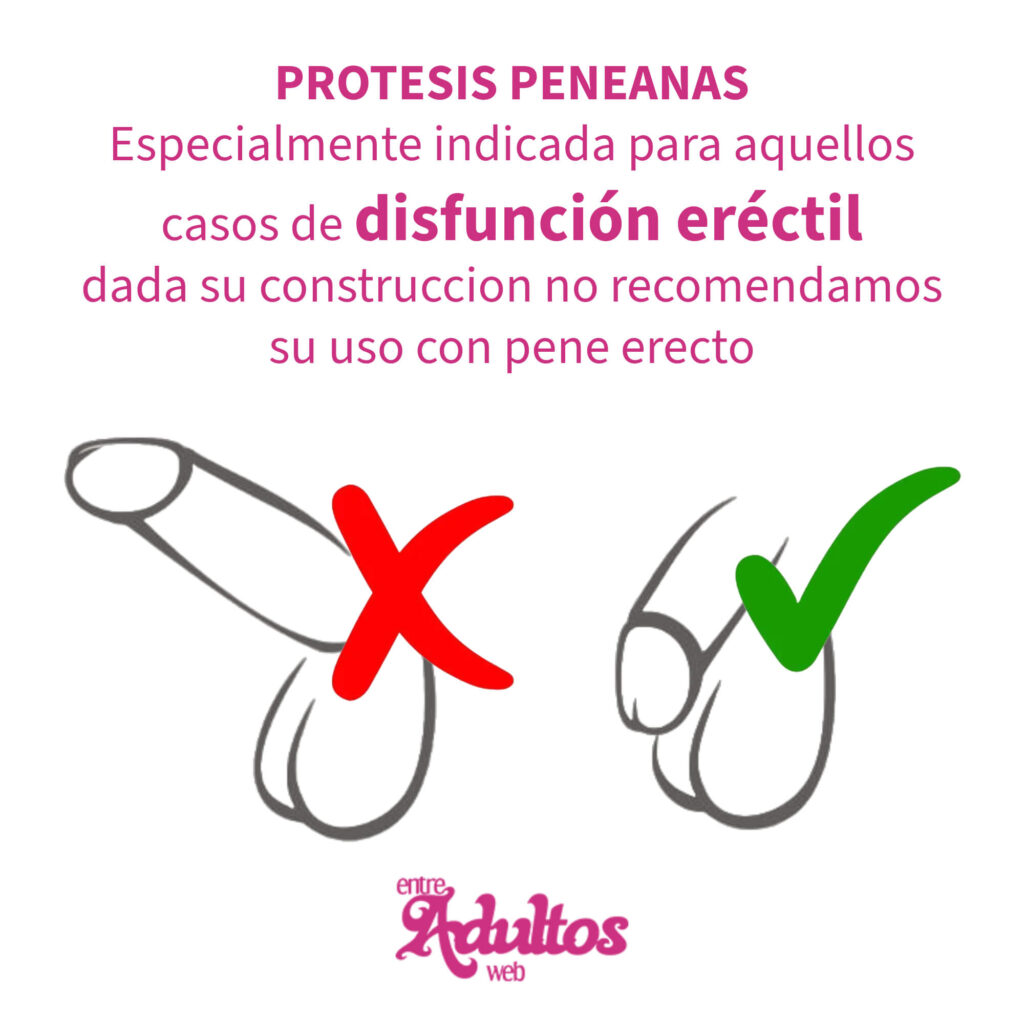 Protesis Peneana Semirigida Pellizcable Mod 5 (13x4cm)